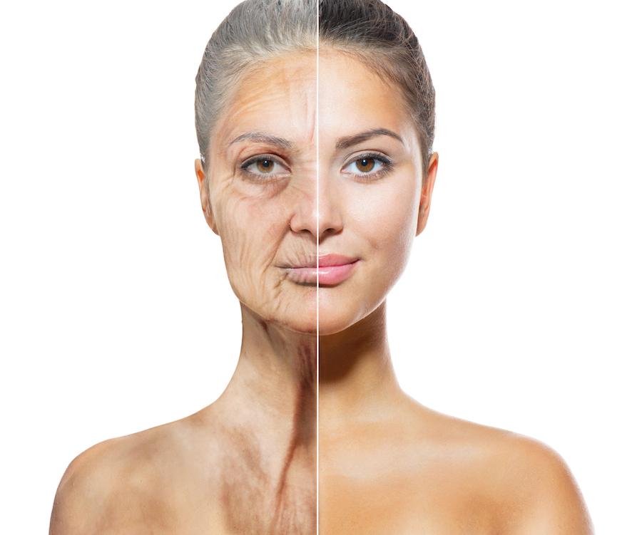3-step-peel-skin-rejuvenation-face-ReNova-Julio-Clavijo-cosmetic-surgery-surgery-before-and-after-pictures-prices-costs-financing-american-society-of-plastic-surgeons-board-certified-Best-TopWexford-Butler-Pittsburgh-Murrysville-Monroeville-Allegheny-Greensburg-Westmoreland-Johnstown-Altoona-(Western-PA)-Youngstown-(OH)-Wheeling-Morgantown-(WV)